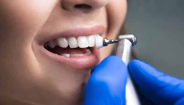 Why Dental Insurance?
